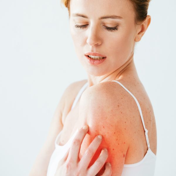 Close-up of inflamed shoulder skin showing contact dermatitis as the immune system reacts to allergens